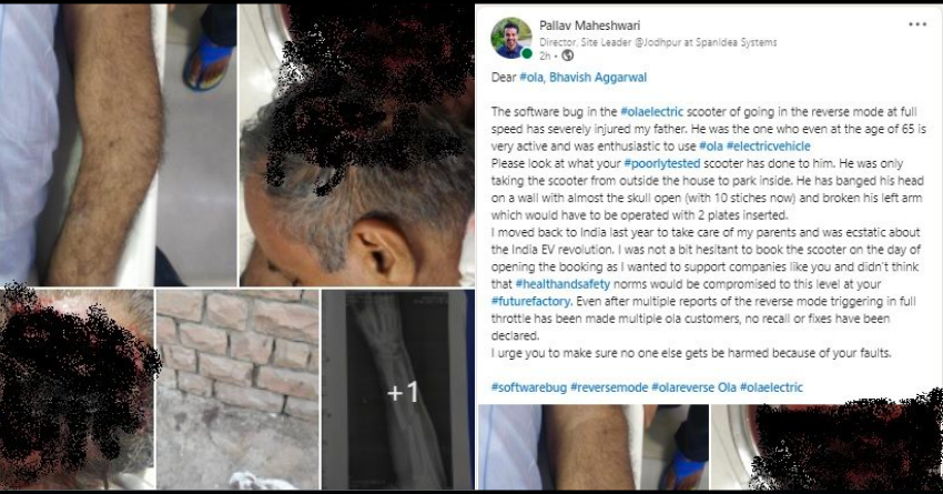 Ola S1 Owner Severely Injured; Scooter Goes Into Reverse Mode At Full Speed
